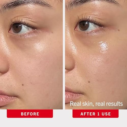 First Aid Beauty Hydrating Eye Cream with Hyaluronic Acid - 24-Hour Moisture, Smooths Fine Lines & Puffiness, Safe for Sensitive Skin, 0.5 oz