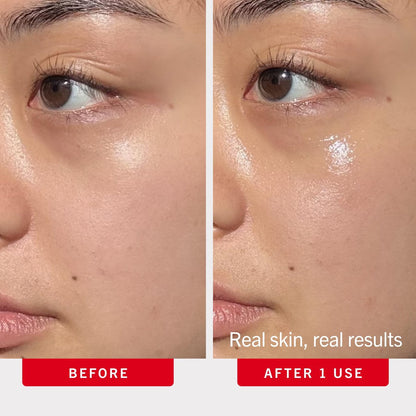 First Aid Beauty Hydrating Eye Cream with Hyaluronic Acid - 24-Hour Moisture, Smooths Fine Lines & Puffiness, Safe for Sensitive Skin, 0.5 oz