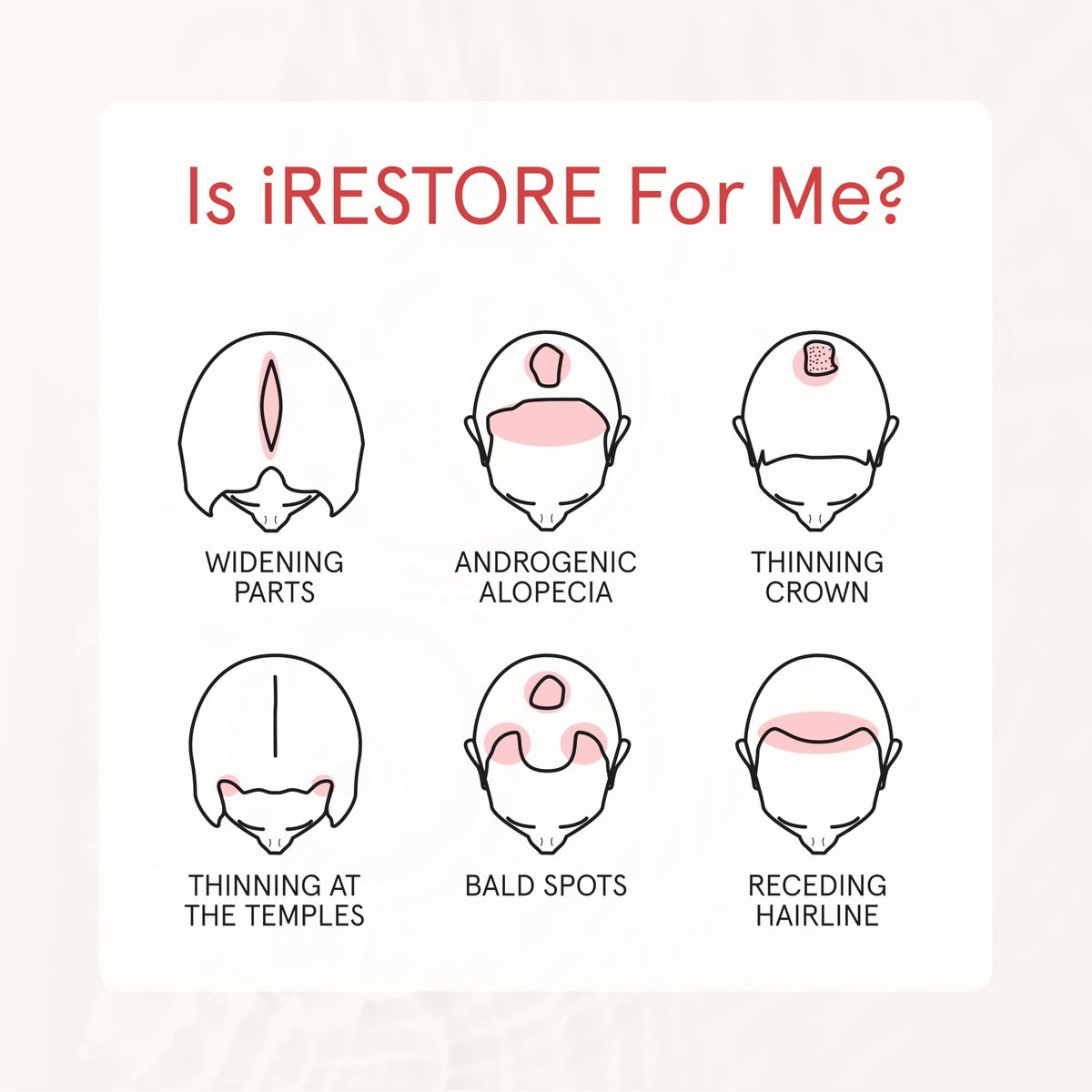 iRESTORE Biotin Hair Conditioner for Damaged Dry Hair - Volumizing & Thickening Conditioner with Ginseng & Argan Oil, Moisturizing for Fine Hair Growth, Pairs with Hair Loss Shampoo Avelisse