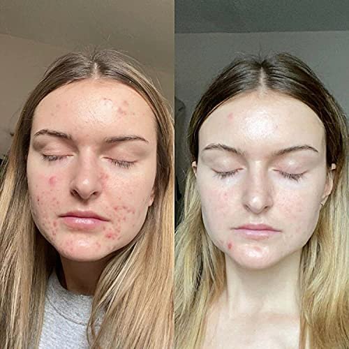Retinol Gel 0.1% Vitamin A – Anti-Aging Formula for Fine Lines, Wrinkles, Scars & Sun Spots (20g) Avelisse