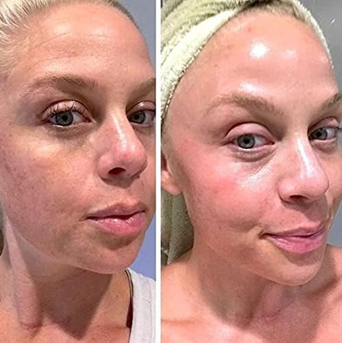 Retinol Gel 0.1% Vitamin A – Anti-Aging Formula for Fine Lines, Wrinkles, Scars & Sun Spots (20g) Avelisse