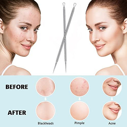 Titanium Lancet Needle Pimple Popper Tool - Professional Blackhead & Blemish Remover (2 Pack) with Box