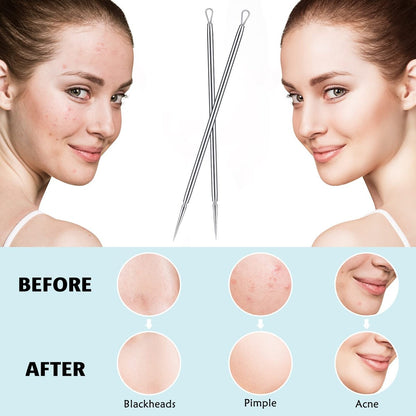 Titanium Lancet Needle Pimple Popper Tool - Professional Blackhead & Blemish Remover (2 Pack) with Box