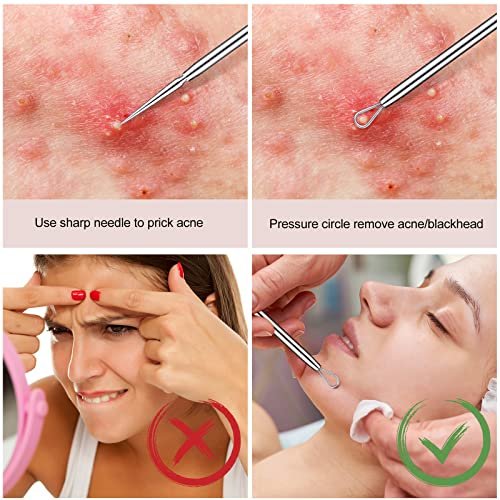 Titanium Lancet Needle Pimple Popper Tool - Professional Blackhead & Blemish Remover (2 Pack) with Box - görsel 14