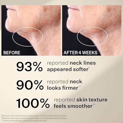 StriVectin Tighten & Lift Peptight™ Tightening Neck Anti-Aging Serum Roller, 1.7 fl. oz. Avelisse