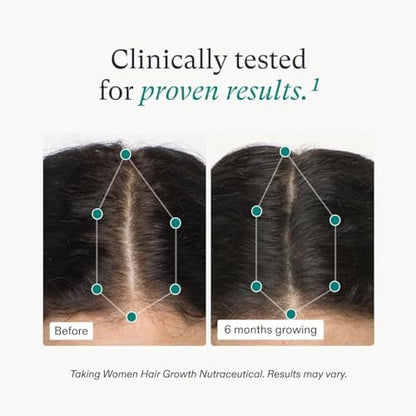 Nutrafol Women's Hair Growth Supplement & Collagen Peptides Powder – Thicker, Stronger Hair – Dermatologist Recommended – 1 Month Supply Avelisse