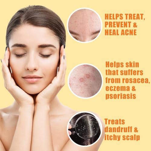 Natrulo 10% Sulfur Soap Cleansing Bar for Face & Body – All Natural Acne Treatment with Lemongrass, Tea Tree Oil & Vitamin E – Made in USA (4 oz, Pack of 2) - görsel 3