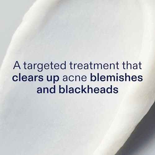 Skinfix 2% BHA Spot Treatment with Niacinamide - 0.5 fl oz - Acne & Blackhead Clearing Serum - Fragrance Free, Vegan & Cruelty Free Avelisse