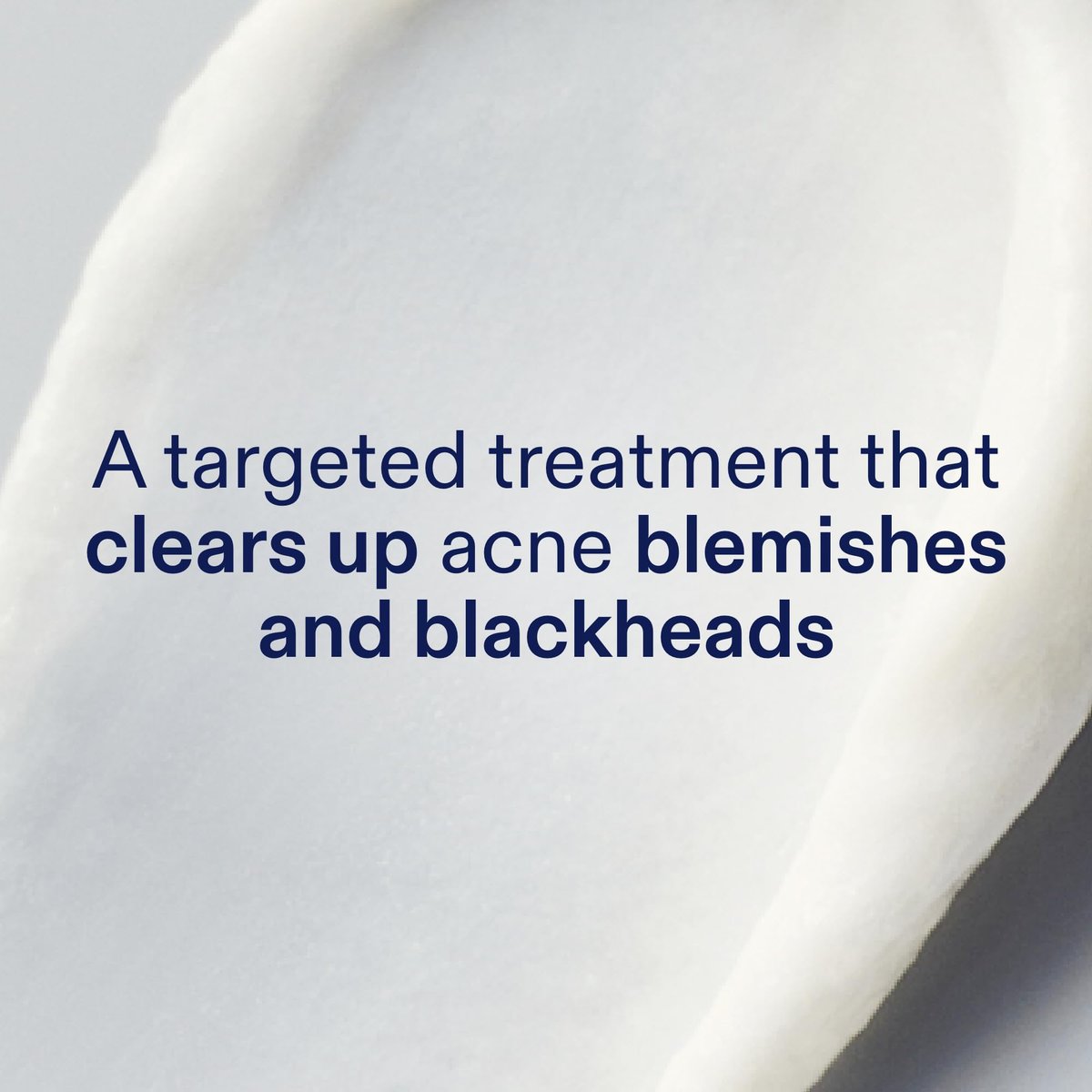 Skinfix 2% BHA Spot Treatment with Niacinamide - 0.5 fl oz - Acne & Blackhead Clearing Serum - Fragrance Free, Vegan & Cruelty Free Avelisse