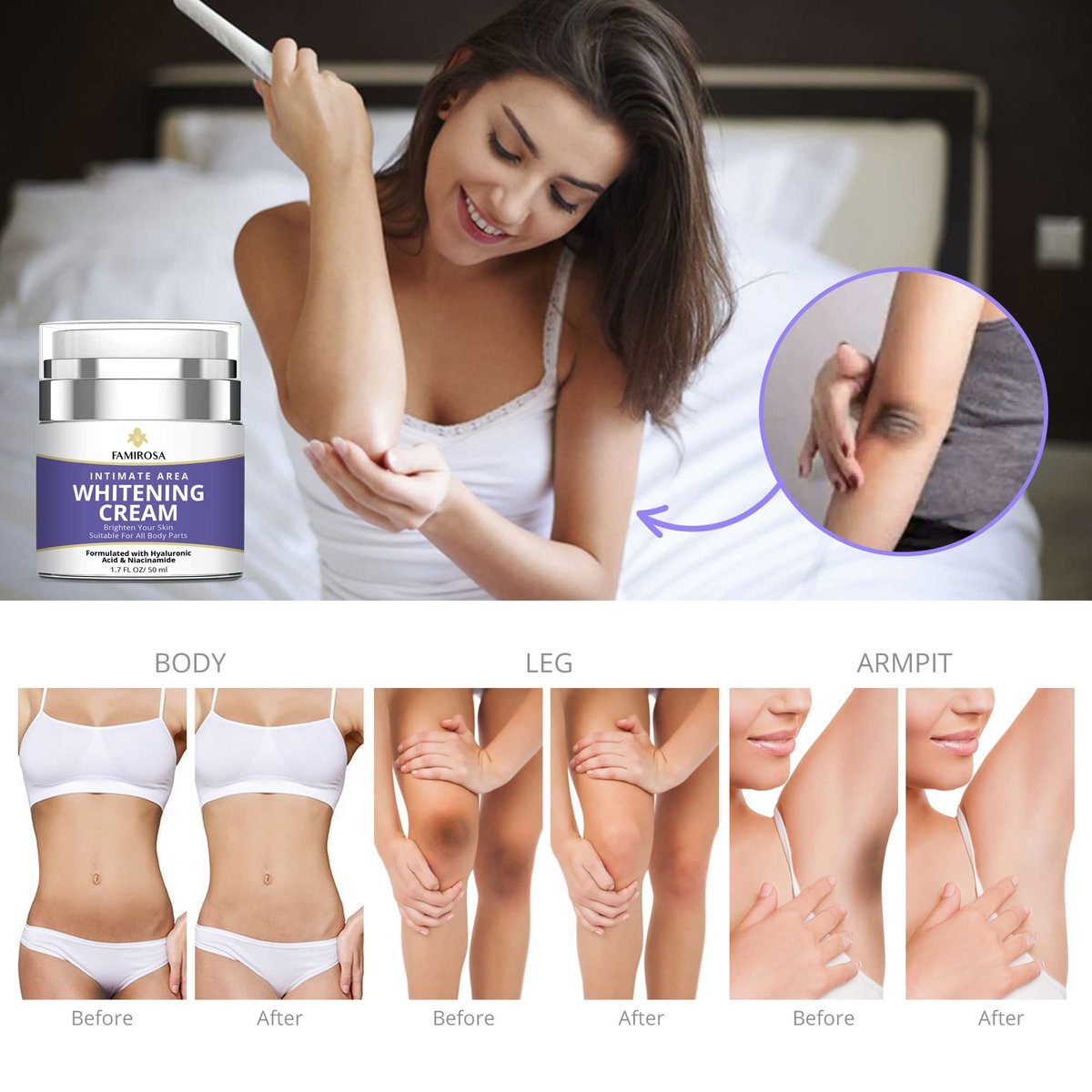 FAMIROSA Intimate Area Dark Spot Corrector - Underarm Cream for Armpit, Knees, Elbows, Inner Thigh, Private Parts - Intimate Skin Cream 50 ml Avelisse
