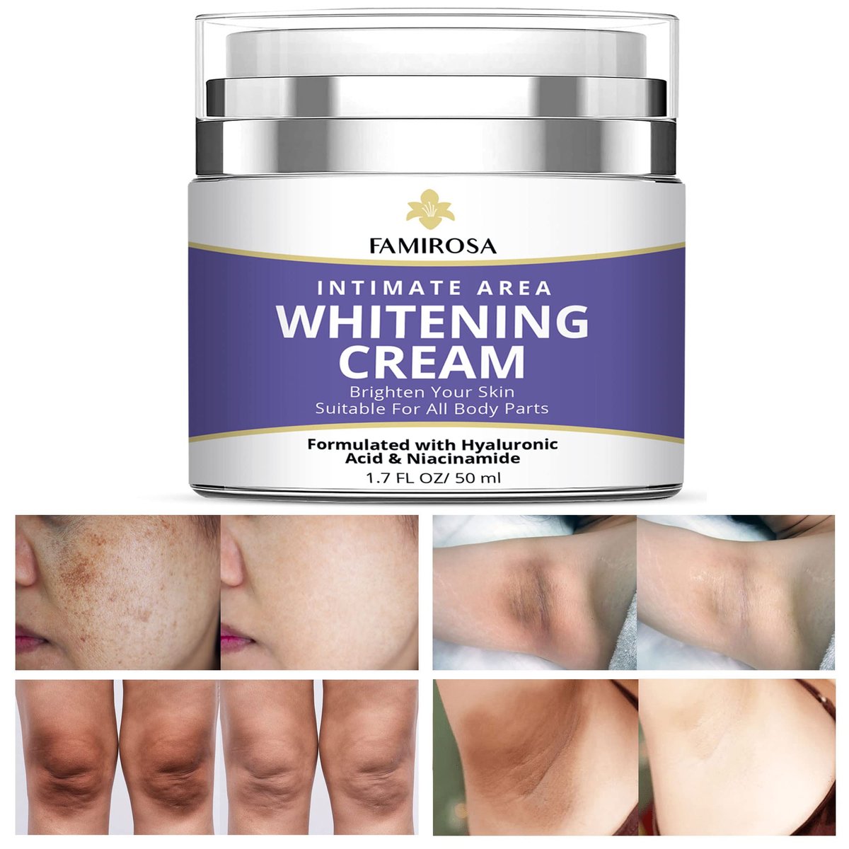 FAMIROSA Intimate Area Dark Spot Corrector - Underarm Cream for Armpit, Knees, Elbows, Inner Thigh, Private Parts - Intimate Skin Cream 50 ml Avelisse