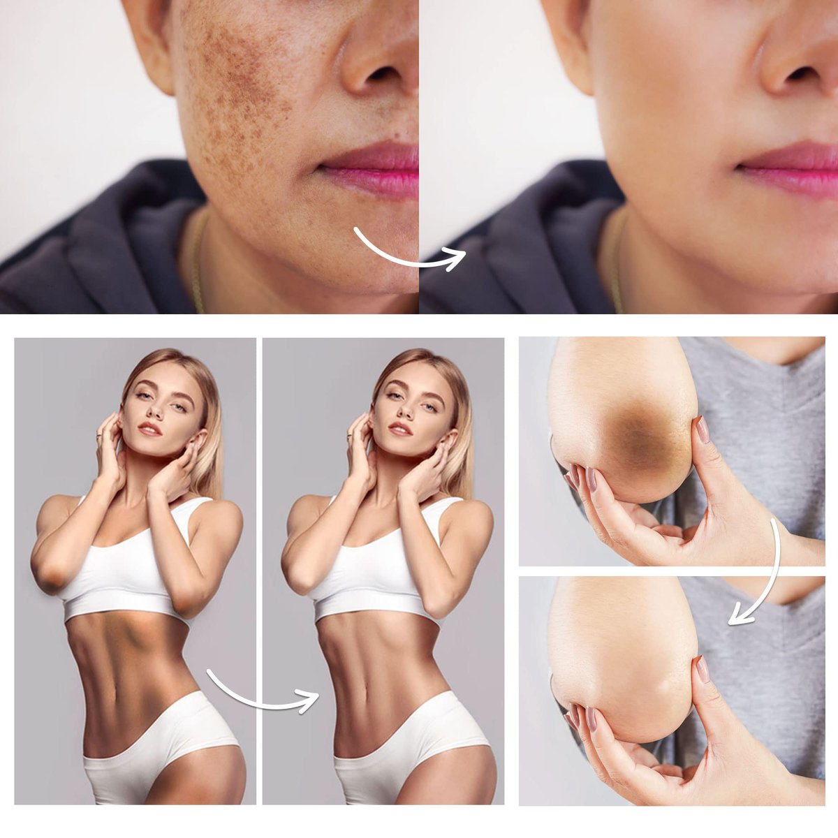 FAMIROSA Intimate Area Dark Spot Corrector - Underarm Cream for Armpit, Knees, Elbows, Inner Thigh, Private Parts - Intimate Skin Cream 50 ml Avelisse