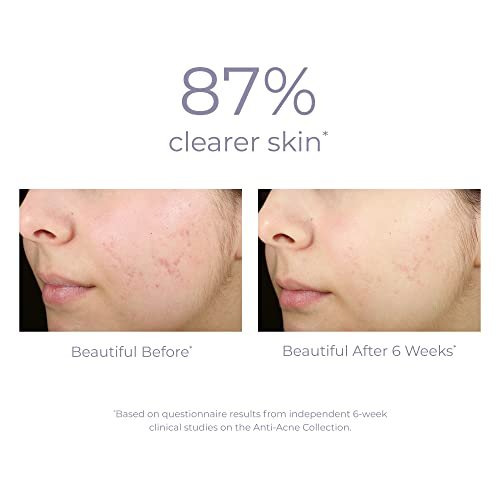 DERMA E Acne Spot Treatment - Clinically Studied Blemish Control Serum for Blackheads, Breakouts & Cystic Acne, 2 Fl Oz Avelisse