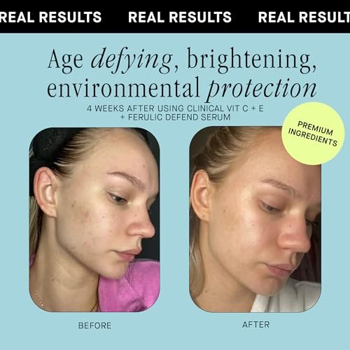 Brandefy Vitamin C Face Serum 15% L-Ascorbic Acid, Ferulic Acid 0.5% + Vitamin E - Dark Spot Corrector & Anti-Aging Serum, 1 oz, Made in USA Avelisse