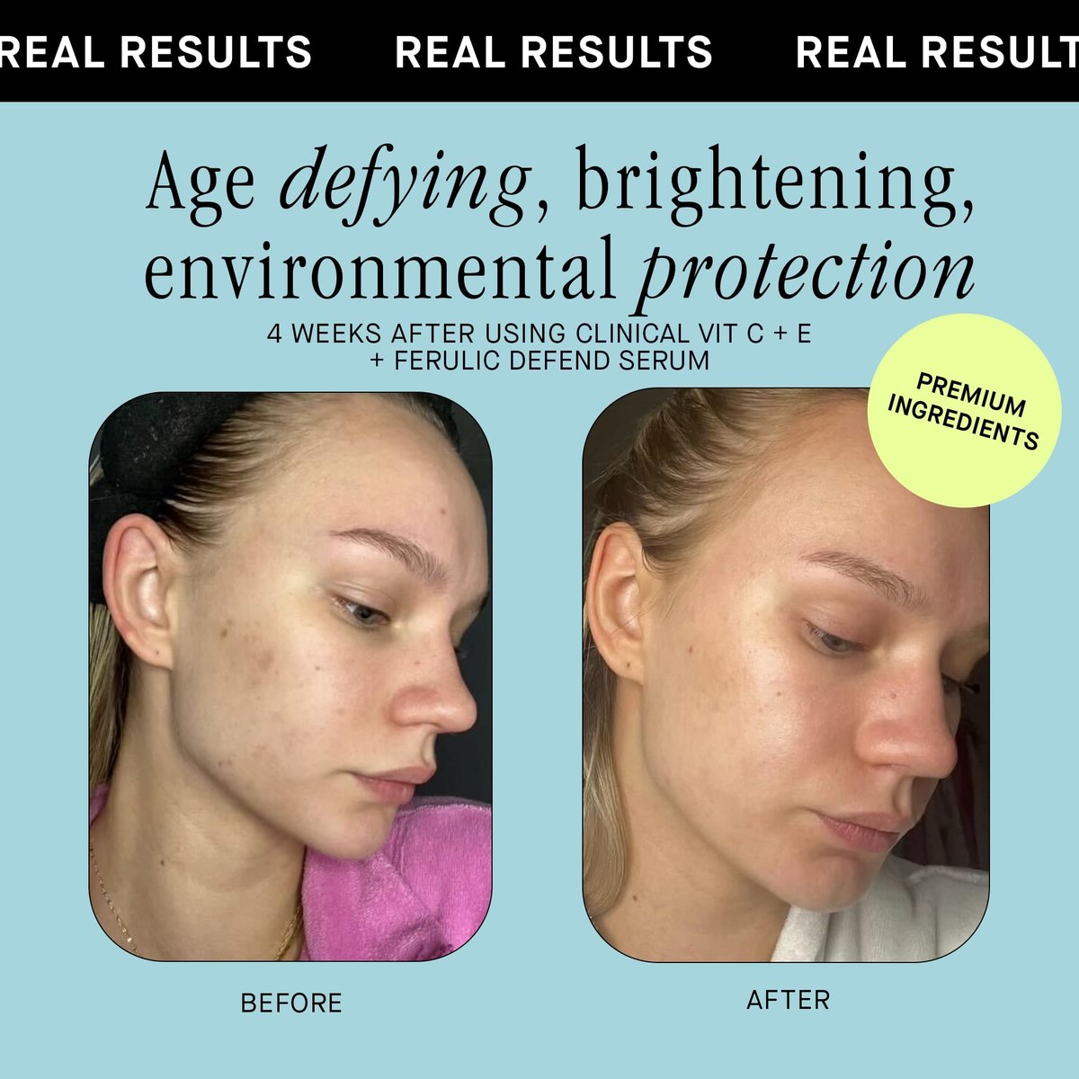 Brandefy Vitamin C Face Serum 15% L-Ascorbic Acid, Ferulic Acid 0.5% + Vitamin E - Dark Spot Corrector & Anti-Aging Serum, 1 oz, Made in USA Avelisse