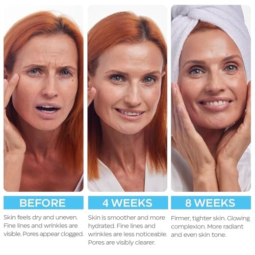 Retinol Cream for Face with Hyaluronic Acid - Anti-Aging Moisturizer for Women & Men, Reduces Wrinkles & Dryness, 1.85 oz Avelisse