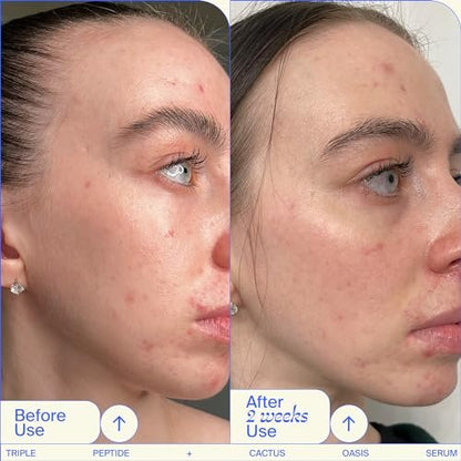 Youth To The People Triple Peptide + Oasis Face Serum - Hydrating & Firming Serum for Dry Skin, Plumps Fine Lines with 4 Types of Hyaluronic Acid & Peptides, Fragrance-Free, 1 fl oz Avelisse