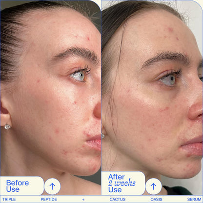 Youth To The People Triple Peptide + Oasis Face Serum - Hydrating & Firming Serum for Dry Skin, Plumps Fine Lines with 4 Types of Hyaluronic Acid & Peptides, Fragrance-Free, 1 fl oz Avelisse