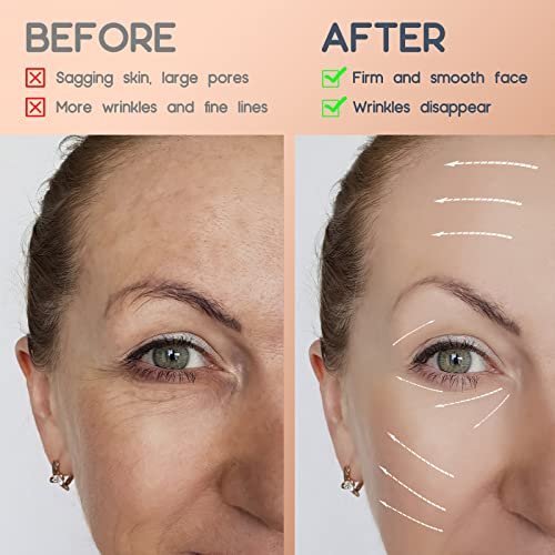 AURUZA 2 Rolls Facial Myofascial Face Lift Tape – Neck & Forehead Anti-Wrinkle Patches for Firming and Tightening Skin (Unisex) - görsel 10