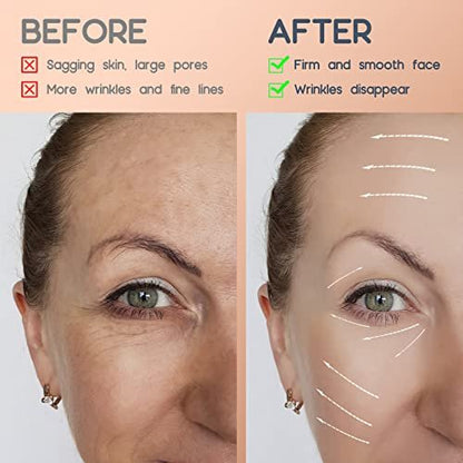 AURUZA 2 Rolls Facial Myofascial Face Lift Tape – Neck & Forehead Anti-Wrinkle Patches for Firming and Tightening Skin (Unisex)