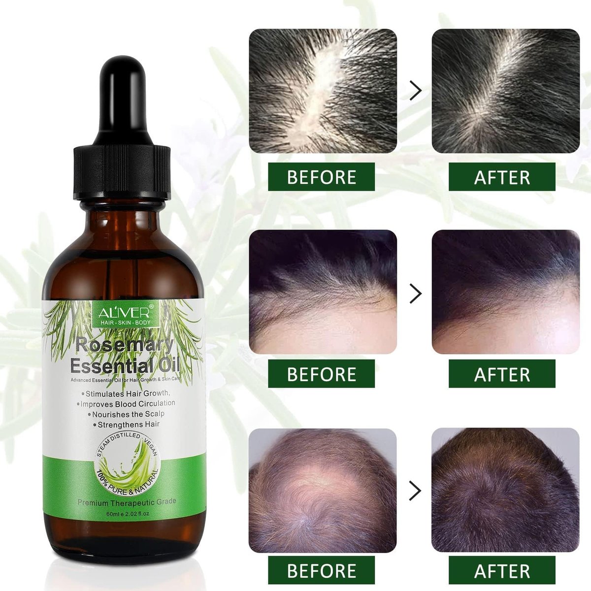 Pure Natural Rosemary Essential Oil for Hair Growth - 2 Pack, Scalp Oil for Dry Damaged Hair (2.02 Fl Oz Each) - görsel 13