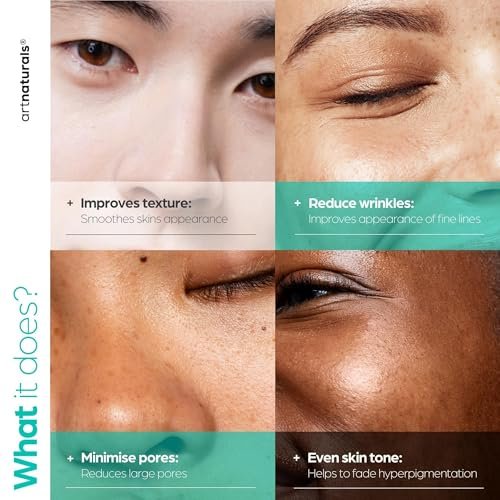 Artnaturals Niacinamide Face Serum 10% with Zinc PCA & Vitamin B3 - Pore Reducer, Mineral Blemish Protection, 1 oz Avelisse
