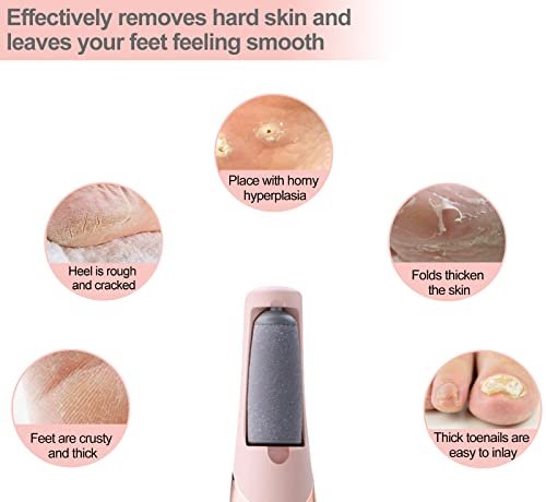 10 Pack Replacement Roller Refills Compatible with Finishing Touch Flawless Pedi Electric Tool File Include a Cleaning Brush (5 Coarse & 5 Fine Rollers) - görsel 12