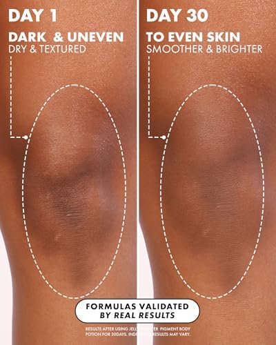 Truly Beauty Jelly Booster Pigment Body Potion - Lightweight Acne Scar Treatment for Face and Body, Fast Absorbing Scar Removal Serum, 3.1 Fl Oz Avelisse