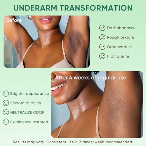 Armpit Detox Scrub & Underarm Exfoliator - Walnut Shell, Menthol & Aloe Vera Body Scrub for Odor, Deodorant Buildup, and Dark Spots - Moisturizing Formula for Sensitive Skin, Vegan 8.8 oz Avelisse