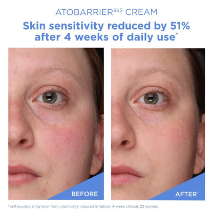 AESTURA ATOBARRIER365 Cream with Ceramides – 120H Hydration & Barrier Repair for Dry, Sensitive Skin (80mL) Avelisse
