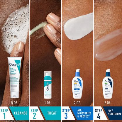 CeraVe Acne Skin Care Set: Foaming Cream Cleanser, Retinol Serum, AM & PM Facial Moisturizers Avelisse