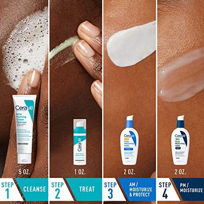 CeraVe Acne Skin Care Set: Foaming Cream Cleanser, Retinol Serum, AM & PM Facial Moisturizers Avelisse