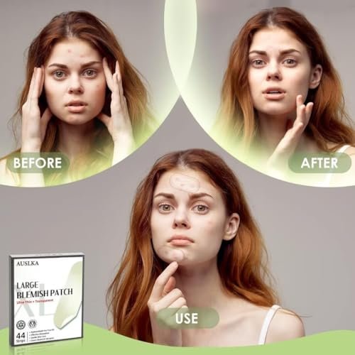 AUSLKA Blemishes Patches - 44 Hydrocolloid Strips for Large Blemishes, Zits & Breakouts – Spot Treatment for Acne-Prone Skin - görsel 6