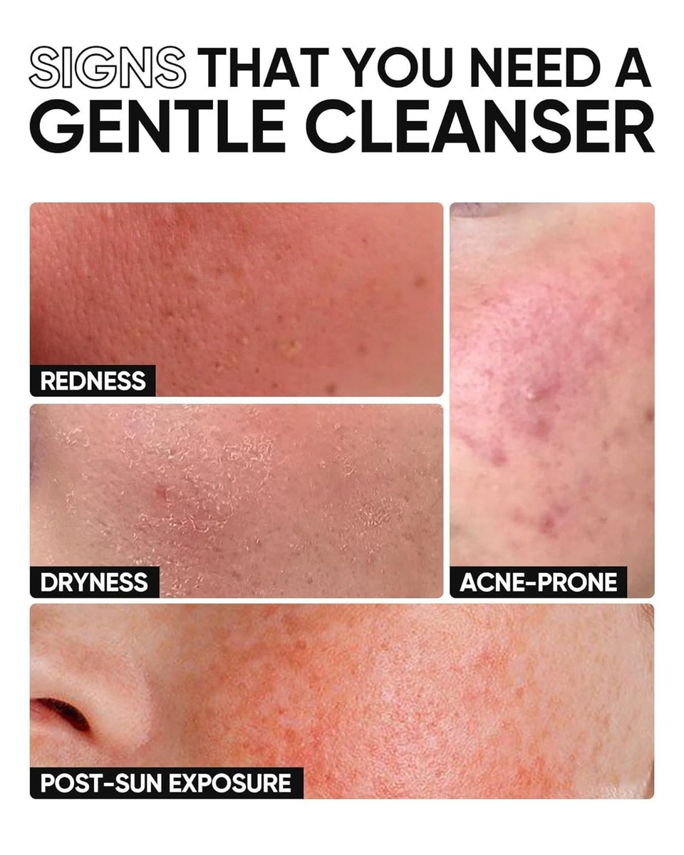 SKINTIFIC 5X Ceramide Low pH Facial Cleanser – Gentle Hydrating Face Wash with Hyaluronic Acid for Dry to Normal Skin, Sensitive Skin Tested, Fragrance Free, 2.67 Fl Oz - görsel 11