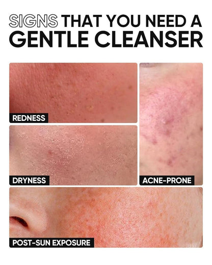 SKINTIFIC 5X Ceramide Low pH Facial Cleanser – Gentle Hydrating Face Wash with Hyaluronic Acid for Dry to Normal Skin, Sensitive Skin Tested, Fragrance Free, 2.67 Fl Oz
