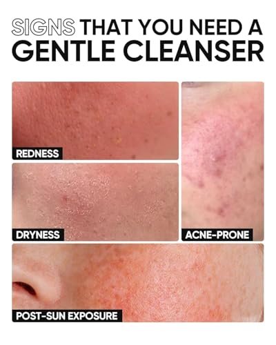 SKINTIFIC 5X Ceramide Low pH Facial Cleanser – Gentle Hydrating Face Wash with Hyaluronic Acid for Dry to Normal Skin, Sensitive Skin Tested, Fragrance Free, 2.67 Fl Oz