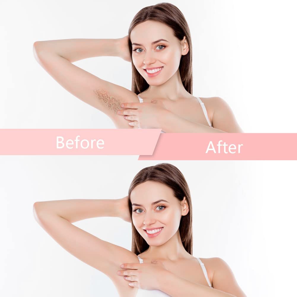 Bestidy Hard Wax Beads for Hair Removal – 500g Rose Pink Refill for Coarse Hair, All Body & Bikini Areas, Women & Men Avelisse