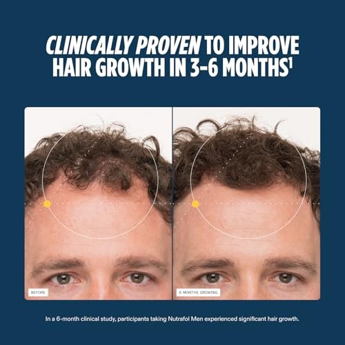 Nutrafol Men's Hair Growth Supplements – Clinically Tested for Thicker Hair & Scalp Coverage, Dermatologist Recommended, 2-Month Supply (2 Refill Pouches) Avelisse
