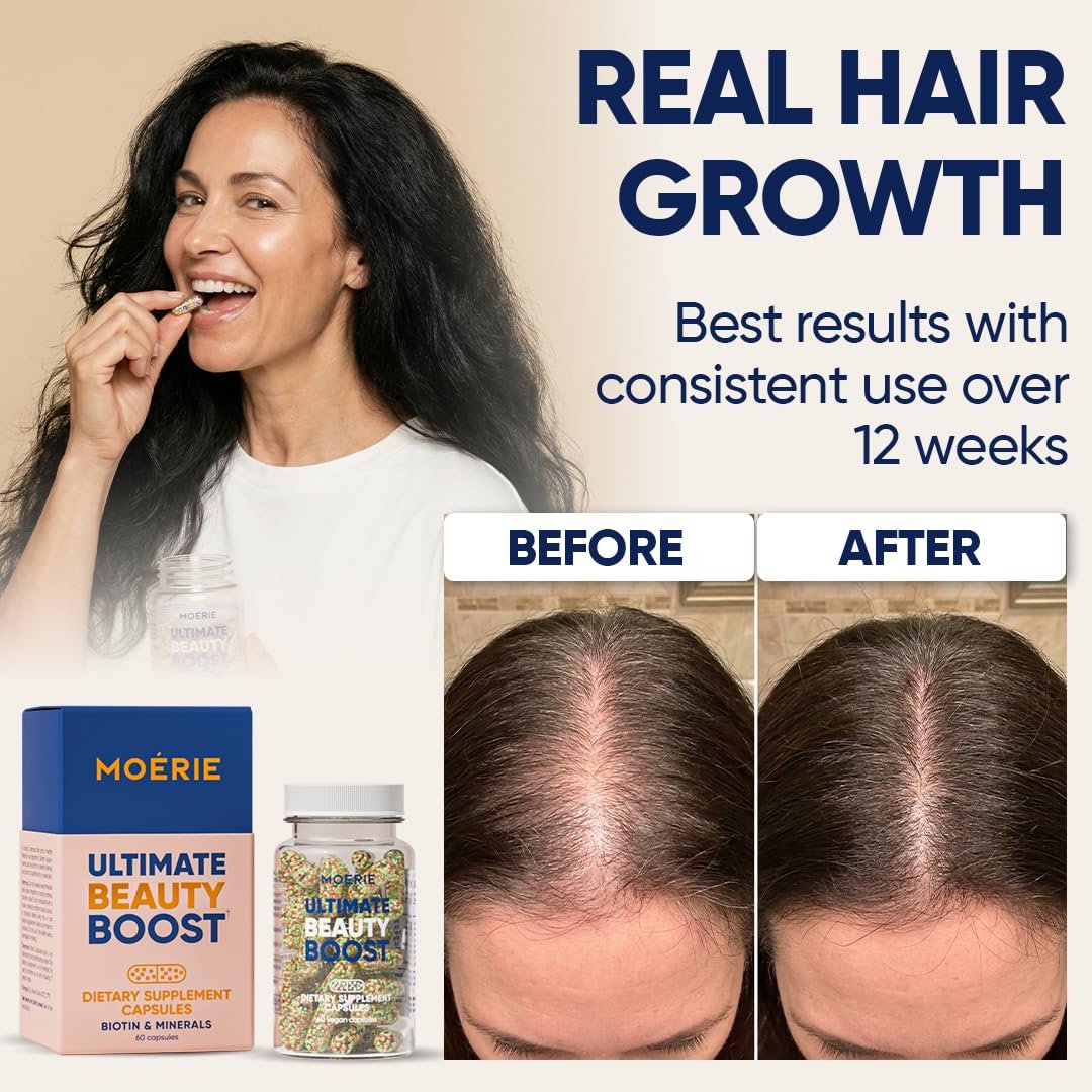 Moerie Ultimate Hair Growth Supplements for Women & Men - Hair, Skin, Nails Vitamins with Biotin & Minerals - for Thicker, Fuller Hair & Hair Loss Treatment - 120 Capsules Avelisse