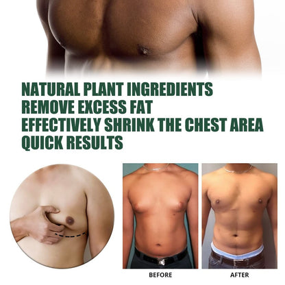 YG LianKai 2-Pack Gynecomastia Tightening Ginger Cream for Men – Chest Firming & Moisturizing Formula