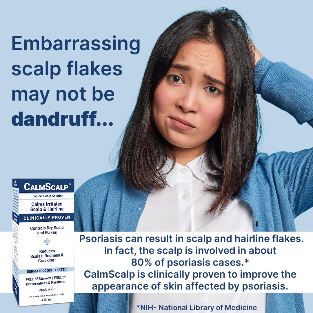 CalmScalp Scalp Treatment - Itch Relief & Exfoliating Scalp Care for Healthier Hair - 4 oz Avelisse