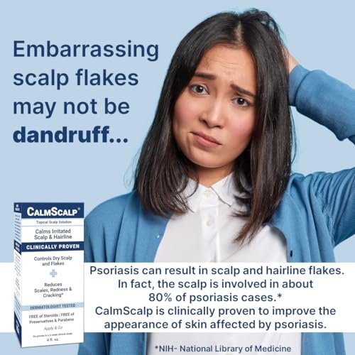 CalmScalp Scalp Treatment - Itch Relief & Exfoliating Scalp Care for Healthier Hair - 4 oz Avelisse