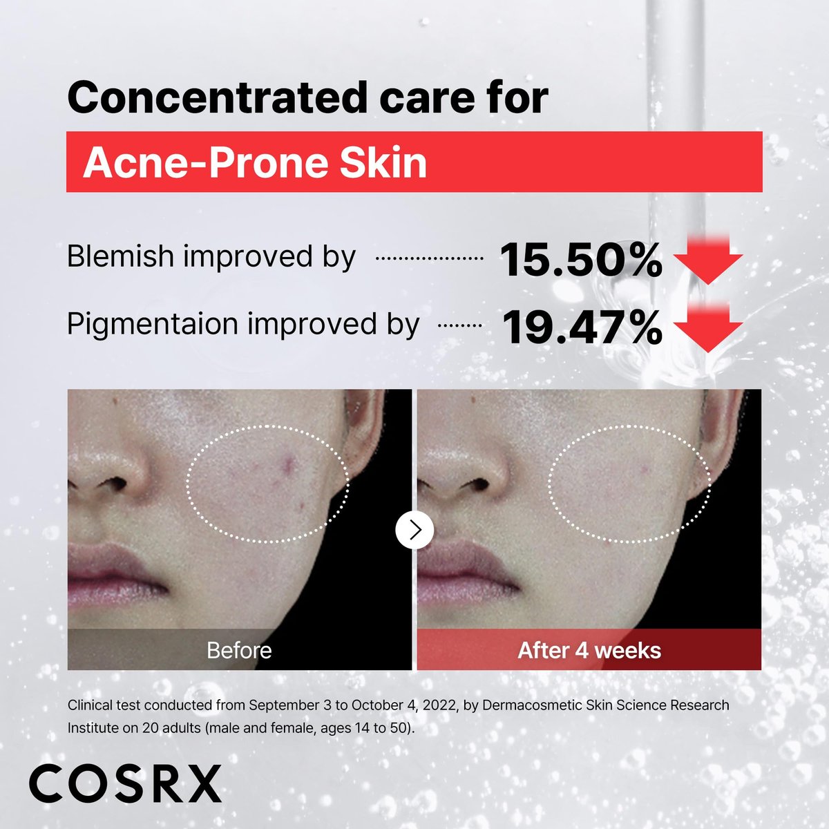 COSRX 15% Niacinamide Face Serum - Pore Minimizer & Even Skin Tone - 0.67 fl oz Korean Skincare Avelisse