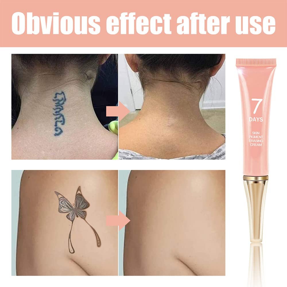 KlsyChry Tattoo Removal Cream – Fast, Painless, Scar-Free Pigment Erasing Formula Avelisse