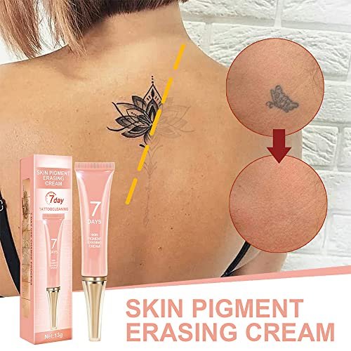 KlsyChry Tattoo Removal Cream – Fast, Painless, Scar-Free Pigment Erasing Formula Avelisse