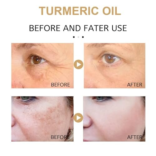 2 Pack Turmeric Dark Spot Corrector Serum Oil – Natural Brightening Face Serum for Dark Spots, Even Skin Tone, and Moisturizing Repair (30ml Each) - görsel 14
