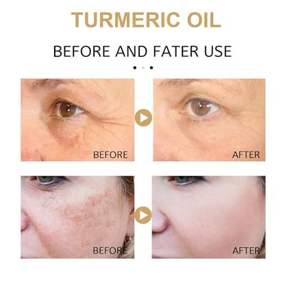2 Pack Turmeric Dark Spot Corrector Serum Oil – Natural Brightening Face Serum for Dark Spots, Even Skin Tone, and Moisturizing Repair (30ml Each)