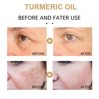 2 Pack Turmeric Dark Spot Corrector Serum Oil – Natural Brightening Face Serum for Dark Spots, Even Skin Tone, and Moisturizing Repair (30ml Each)