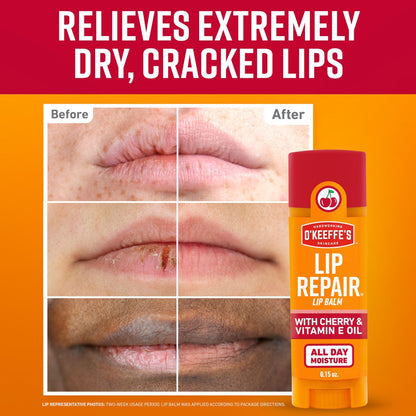 O'Keeffe's Lip Repair Lip Balm with Cherry & Vitamin E Oil - Twin Pack Stick Moisturizer for Extremely Cracked, Dry Lips