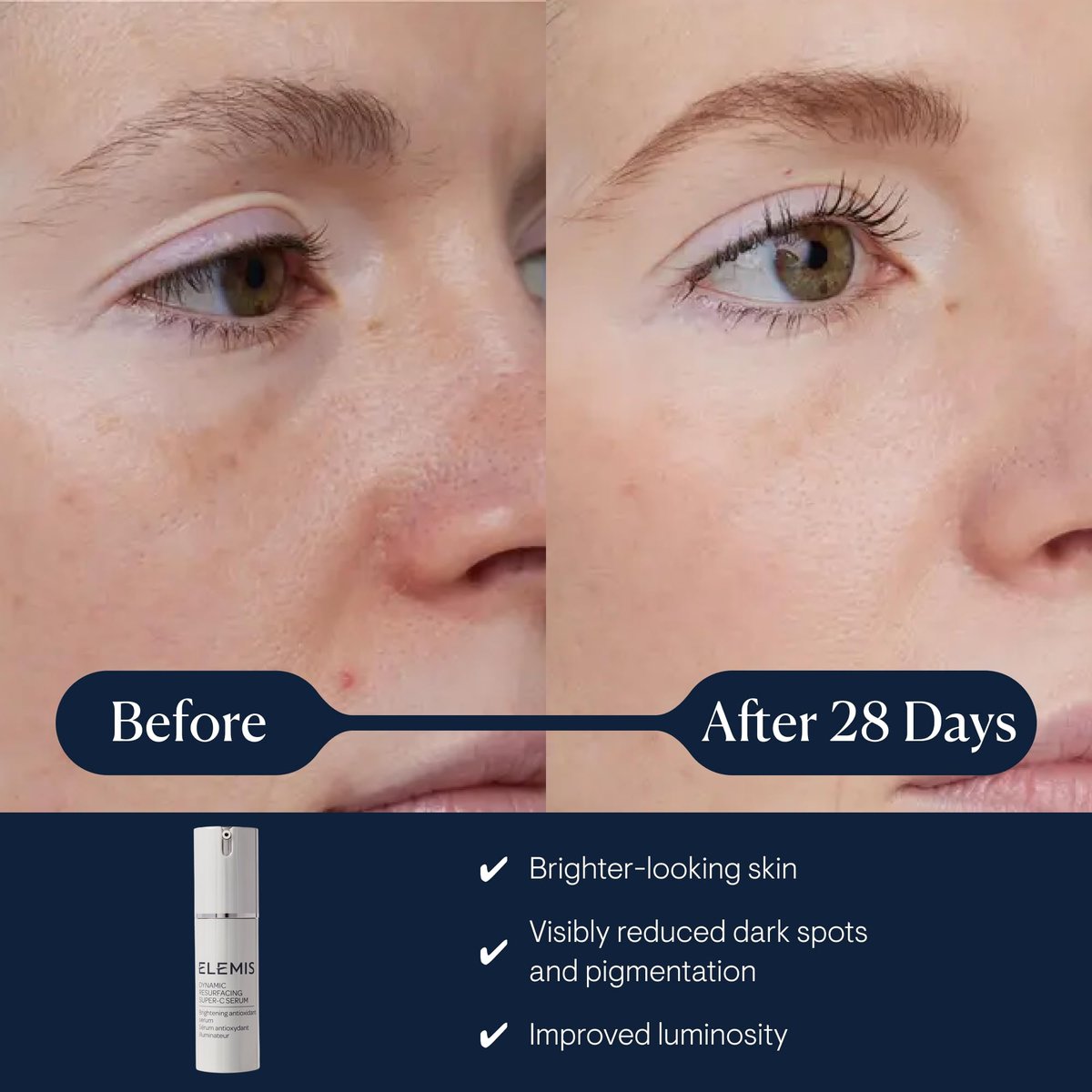 ELEMIS Dynamic Resurfacing Super-C Serum | Vitamin C Anti-Aging Serum for Brightening & Refining Skin Avelisse